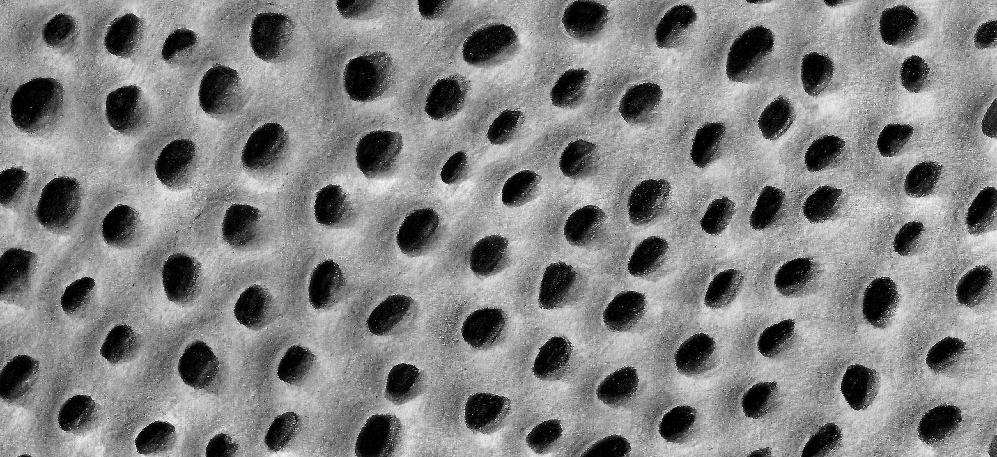 Tooth enamel microstructure with visible pits and pores